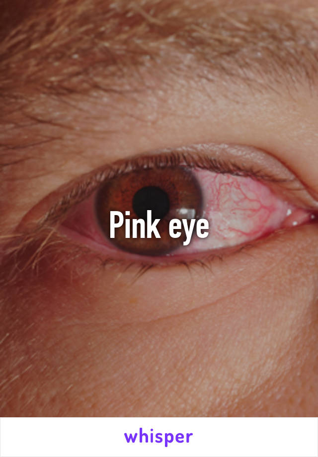 Pink eye