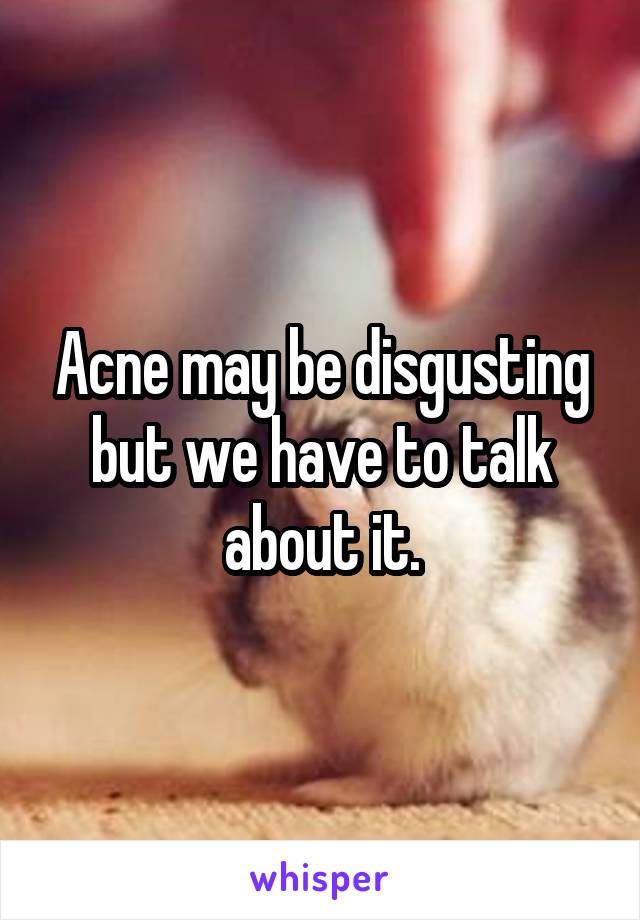 Acne may be disgusting but we have to talk about it.