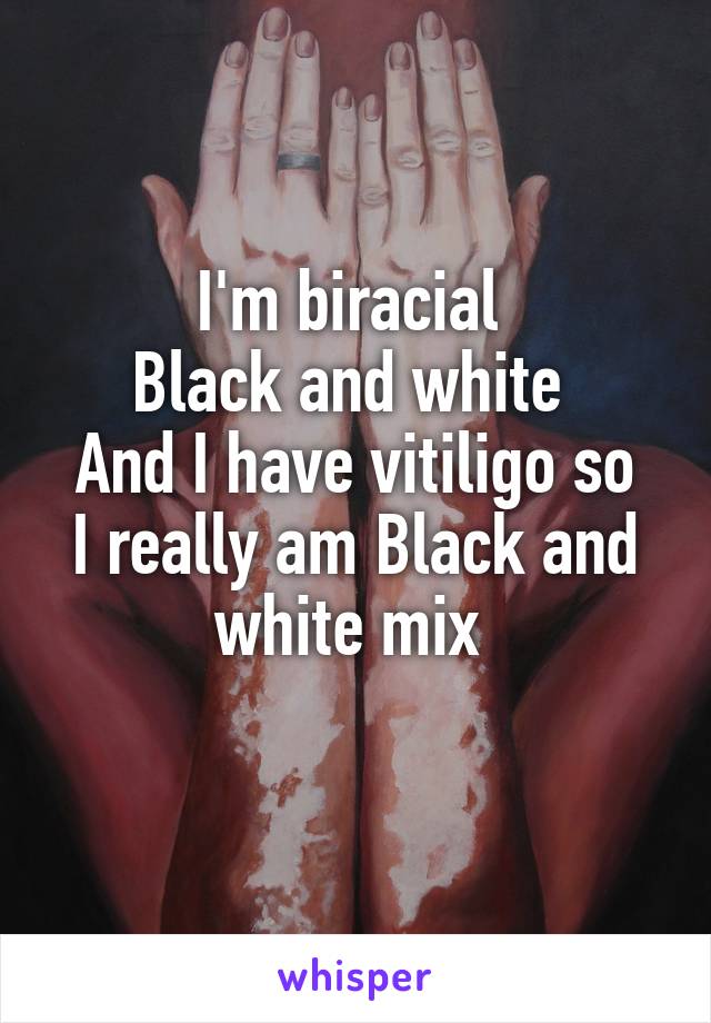 I'm biracial 
Black and white 
And I have vitiligo so I really am Black and white mix 
