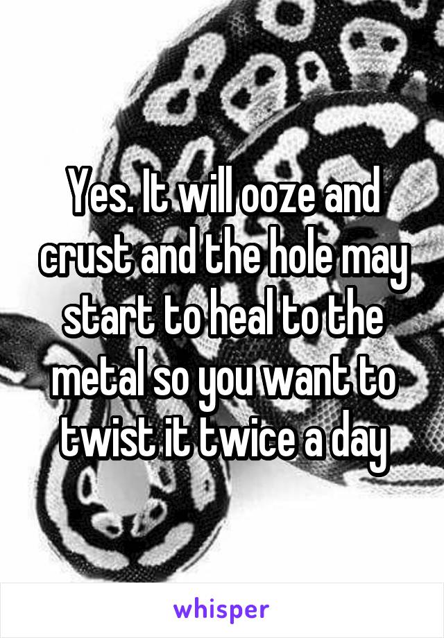 Yes. It will ooze and crust and the hole may start to heal to the metal so you want to twist it twice a day