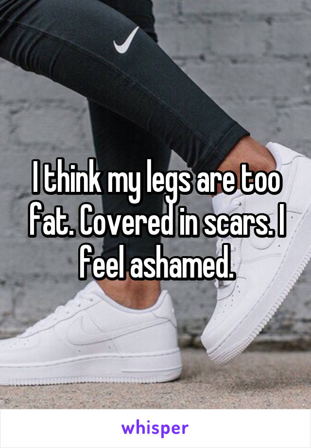 I think my legs are too fat. Covered in scars. I feel ashamed.