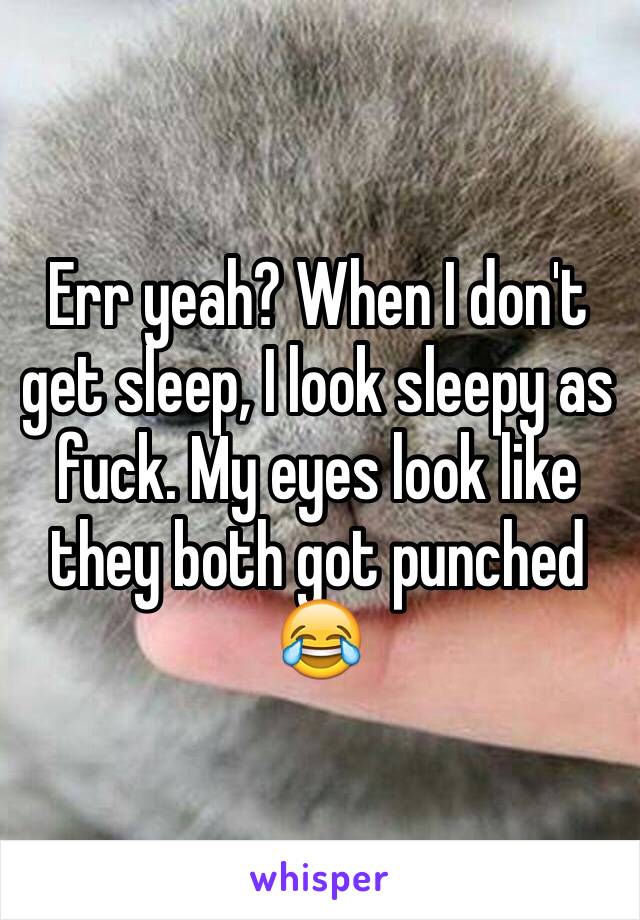 Err yeah? When I don't get sleep, I look sleepy as fuck. My eyes look like they both got punched 😂 