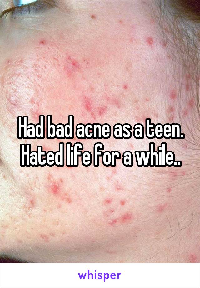 Had bad acne as a teen. Hated life for a while..