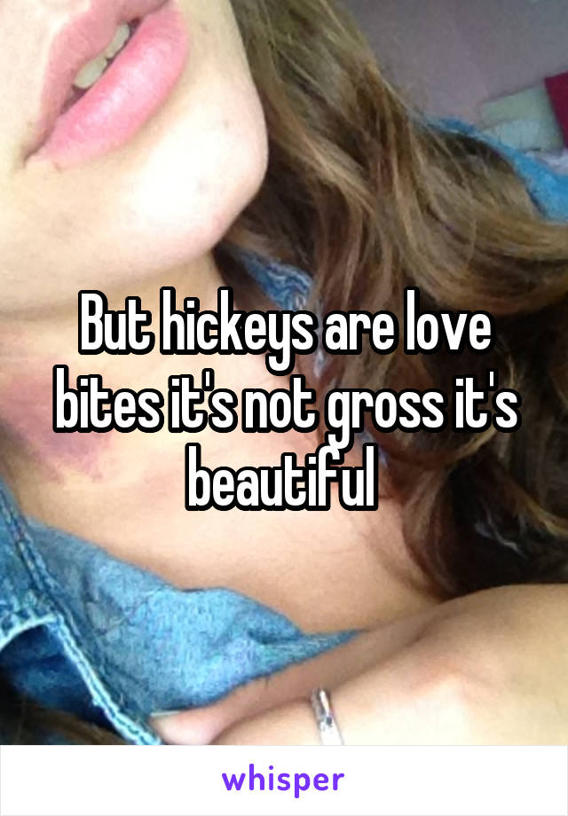 But hickeys are love bites it's not gross it's beautiful 