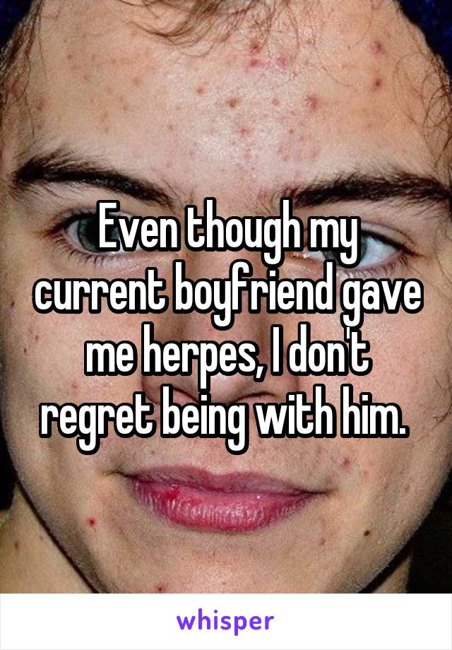 Even though my current boyfriend gave me herpes, I don't regret being with him. 
