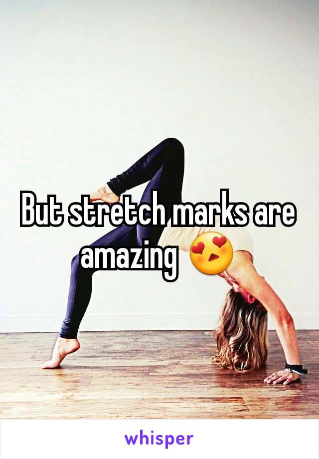 But stretch marks are amazing 😍