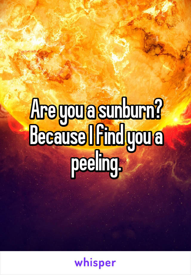 Are you a sunburn? Because I find you a peeling.