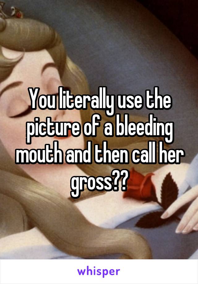 You literally use the picture of a bleeding mouth and then call her gross??