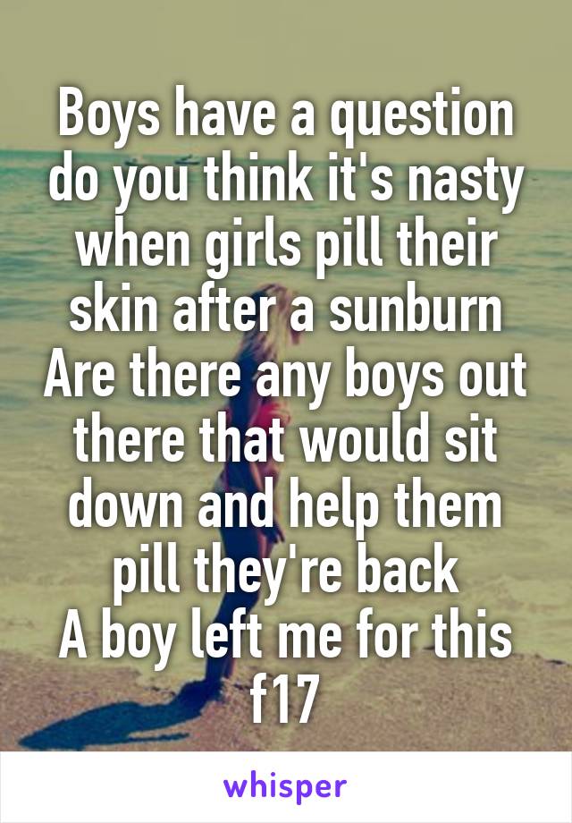 Boys have a question do you think it's nasty when girls pill their skin after a sunburn Are there any boys out there that would sit down and help them pill they're back
A boy left me for this f17
