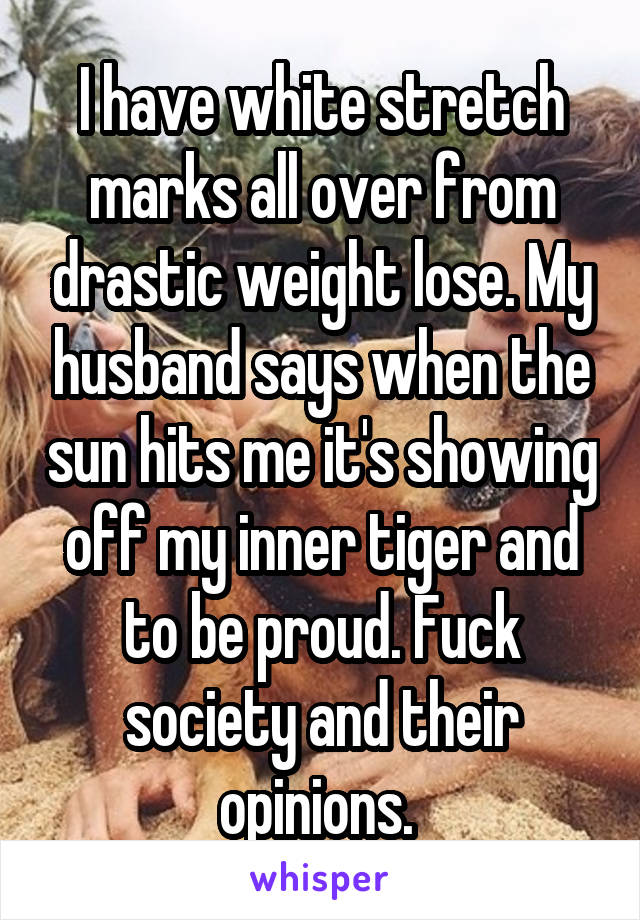 I have white stretch marks all over from drastic weight lose. My husband says when the sun hits me it's showing off my inner tiger and to be proud. Fuck society and their opinions. 