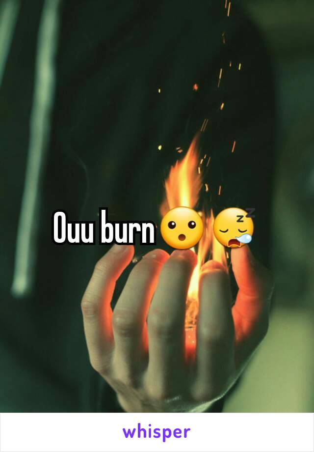 Ouu burn😮😪