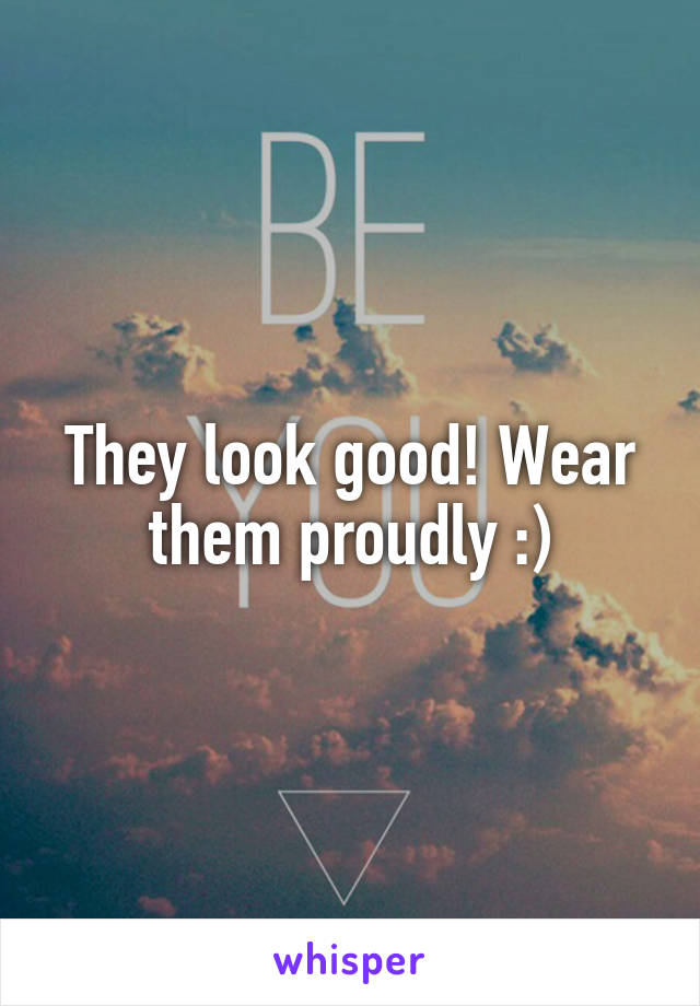 They look good! Wear them proudly :)