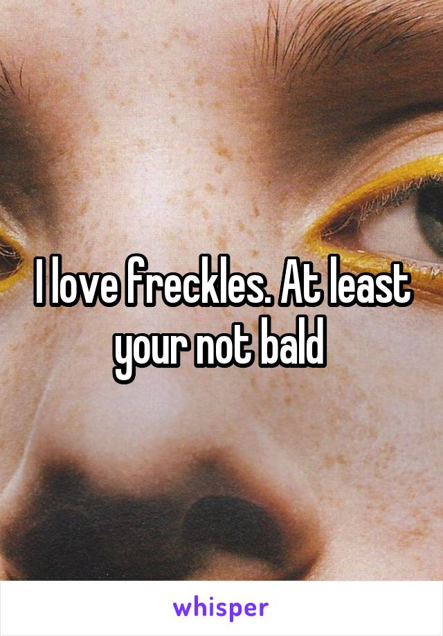 I love freckles. At least your not bald 