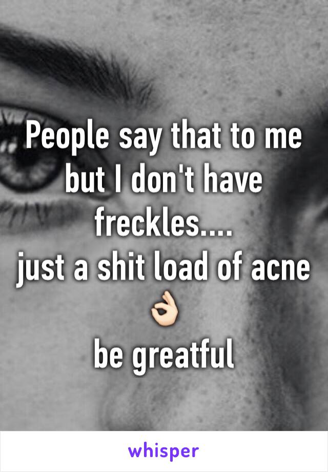 People say that to me but I don't have freckles....
just a shit load of acne
👌🏻
be greatful 