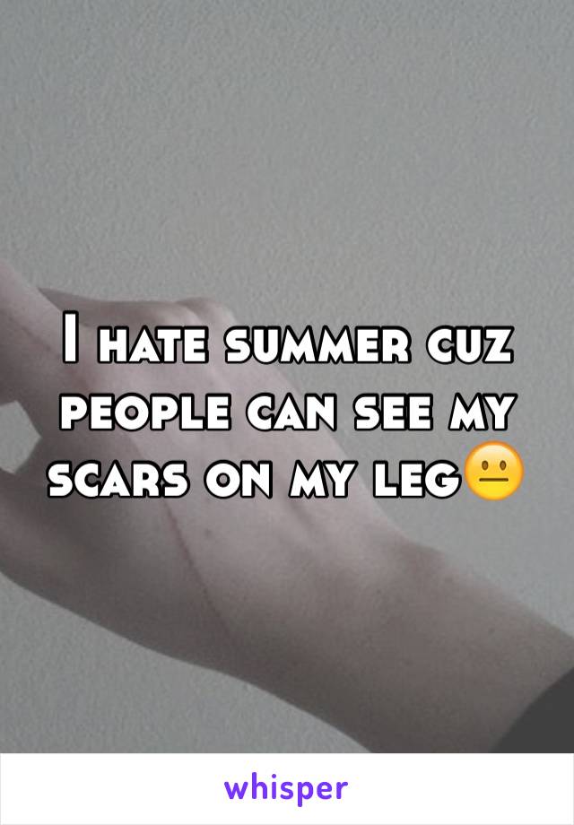 I hate summer cuz people can see my scars on my leg😐