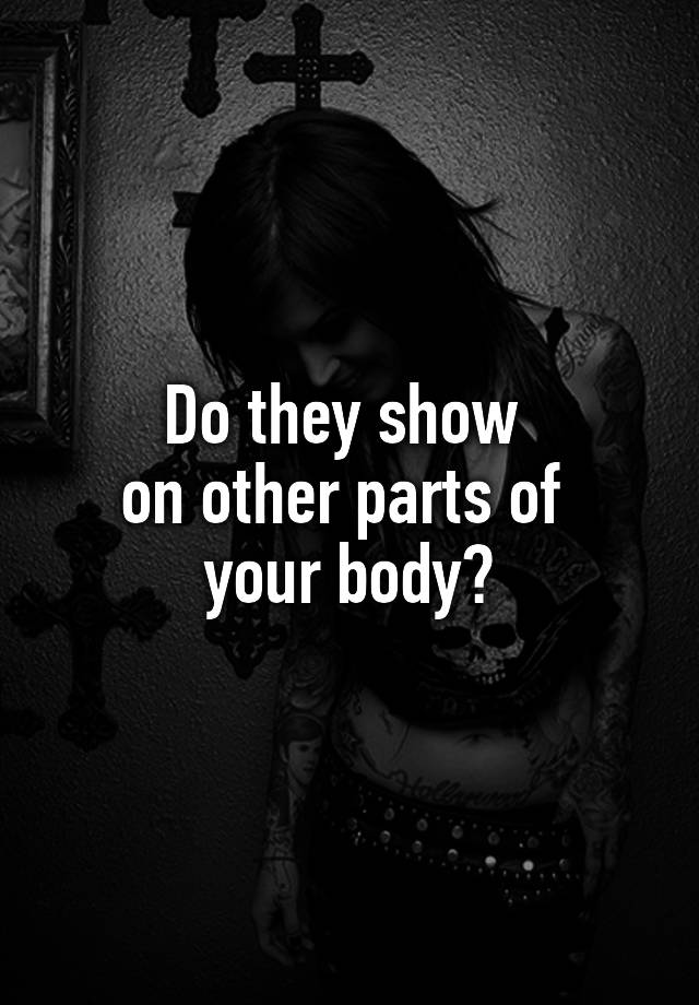 do-they-show-on-other-parts-of-your-body