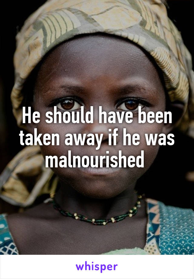 He should have been taken away if he was malnourished 