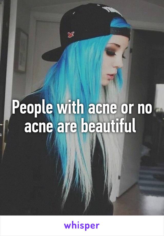 People with acne or no acne are beautiful 