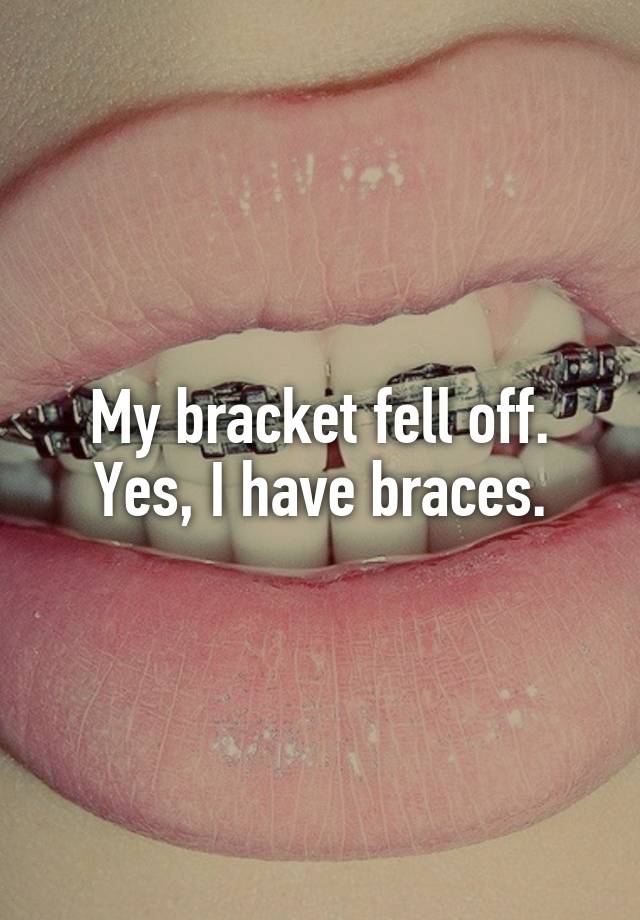 My Band Fell Off My Braces at Clarence Simpson blog