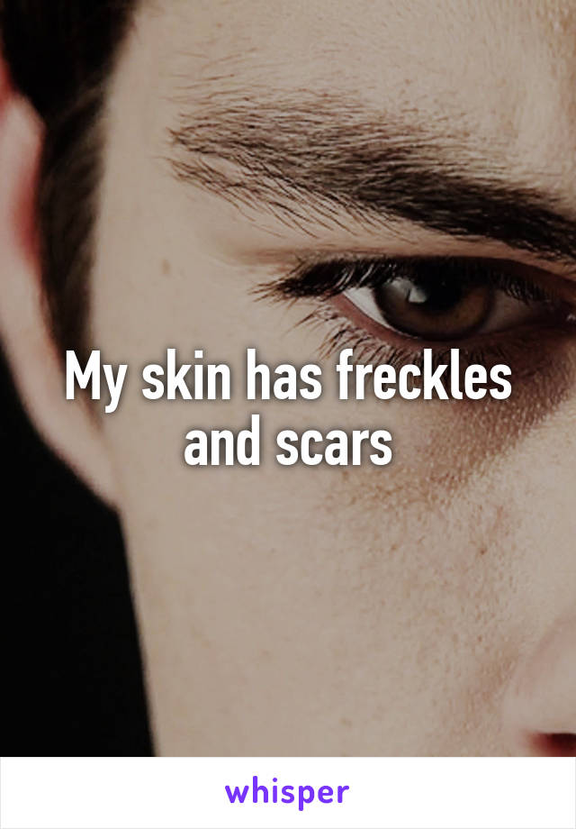 My skin has freckles and scars