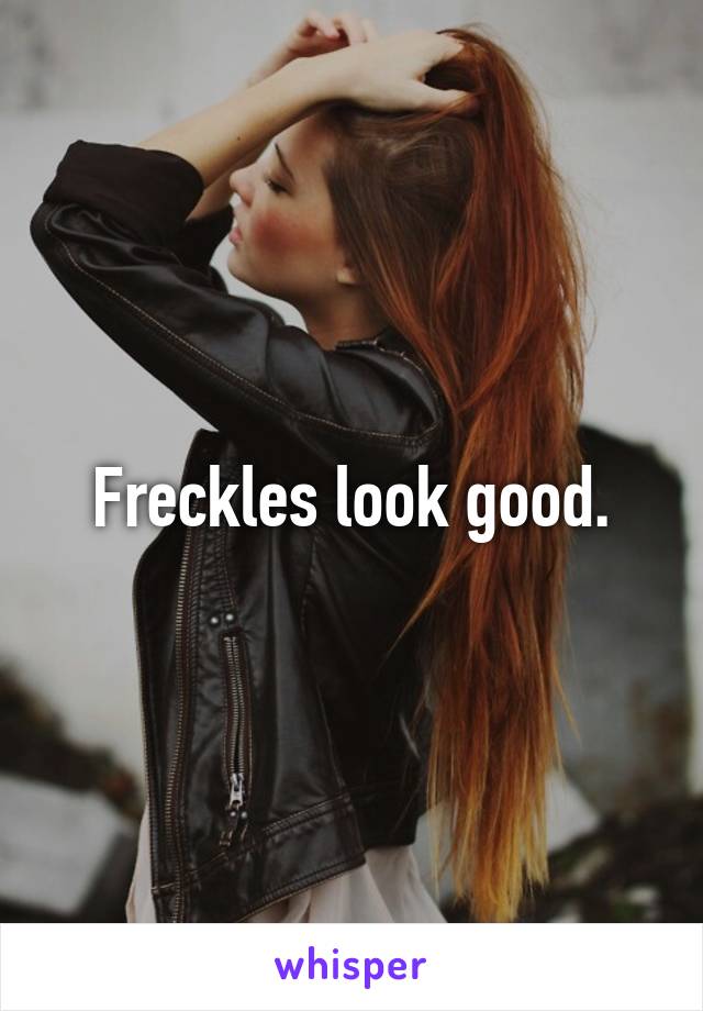 Freckles look good.