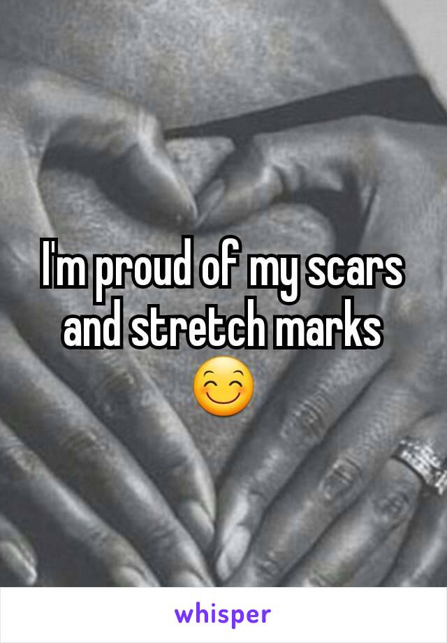 I'm proud of my scars and stretch marks 😊