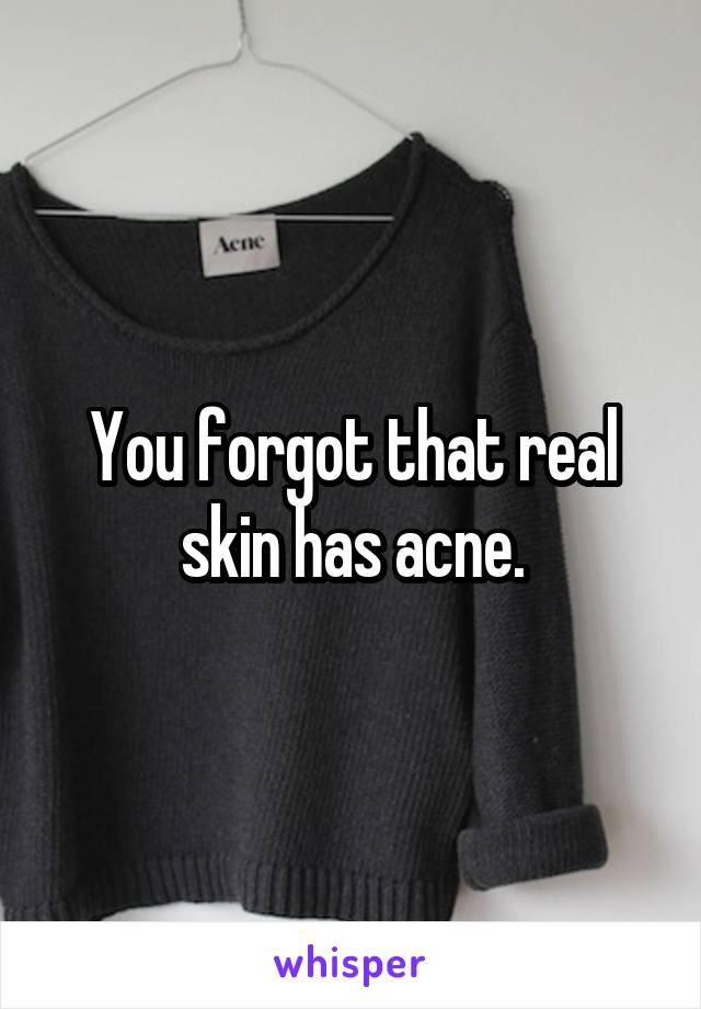 You forgot that real skin has acne.