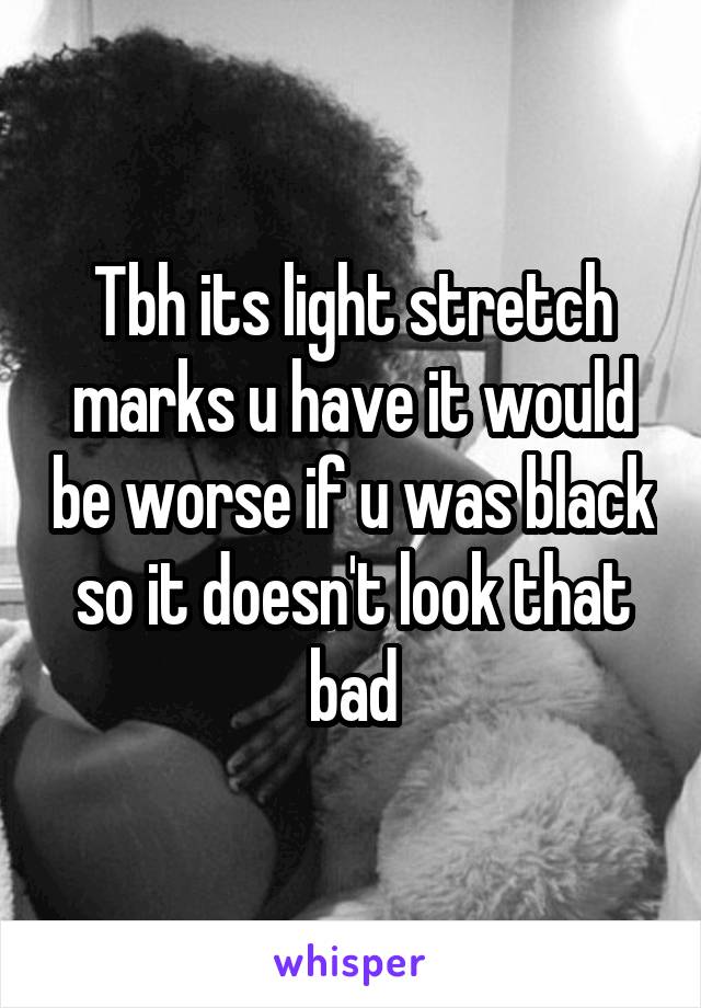 Tbh its light stretch marks u have it would be worse if u was black so it doesn't look that bad