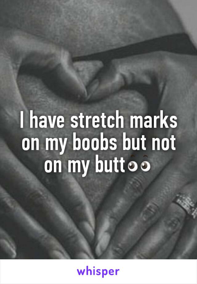 I have stretch marks on my boobs but not on my butt👀