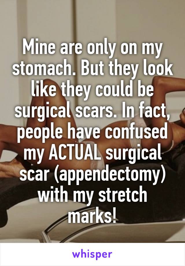 Mine are only on my stomach. But they look like they could be surgical scars. In fact, people have confused my ACTUAL surgical scar (appendectomy) with my stretch marks!