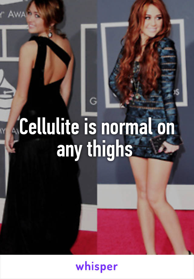 Cellulite is normal on any thighs 