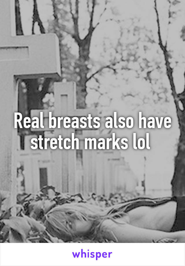 Real breasts also have stretch marks lol 