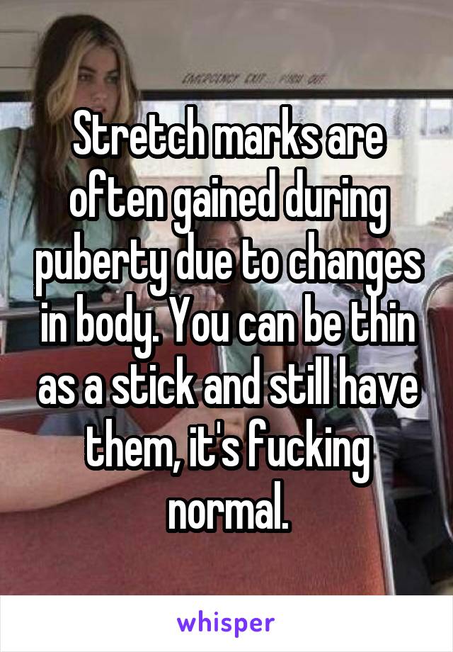 Stretch marks are often gained during puberty due to changes in body. You can be thin as a stick and still have them, it's fucking normal.
