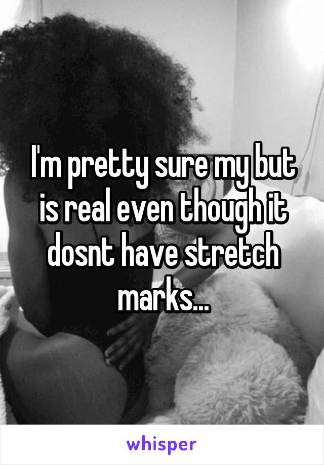 I'm pretty sure my but is real even though it dosnt have stretch marks...