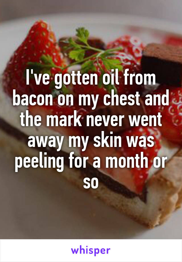 I've gotten oil from bacon on my chest and the mark never went away my skin was peeling for a month or so