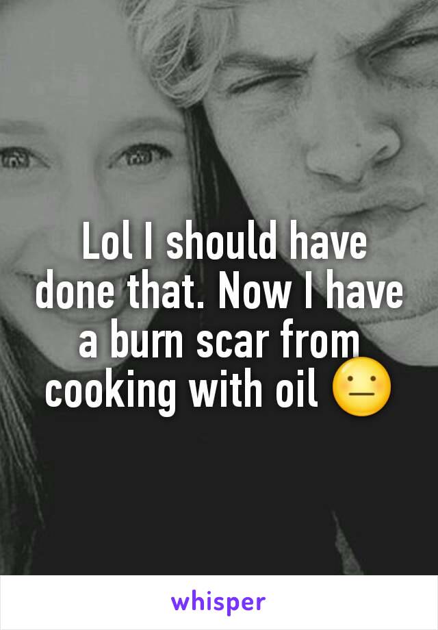  Lol I should have done that. Now I have a burn scar from cooking with oil 😐