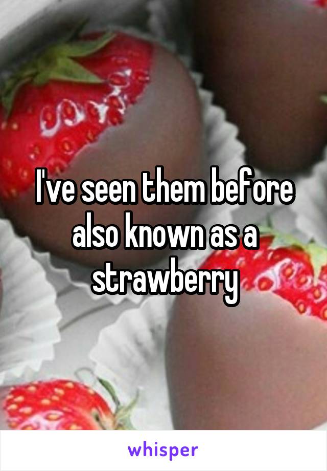 I've seen them before also known as a strawberry