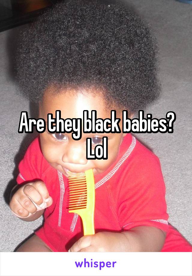 Are they black babies? Lol