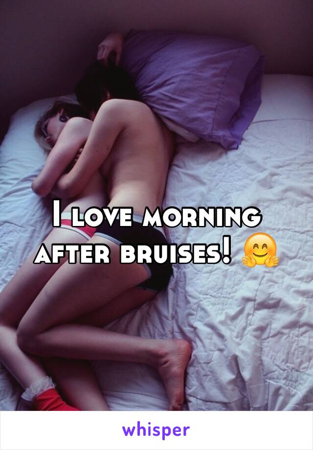 I love morning after bruises! 🤗