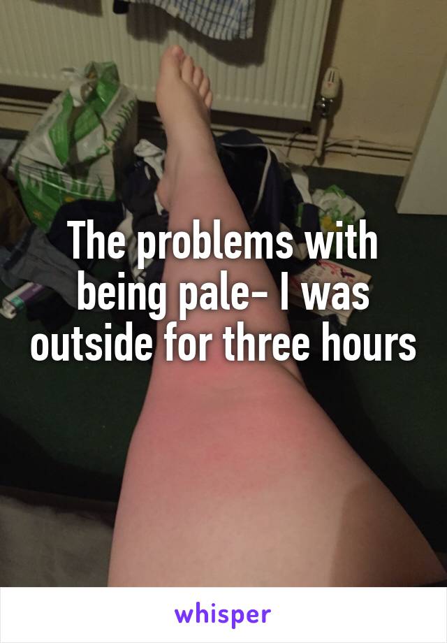 The problems with being pale- I was outside for three hours 