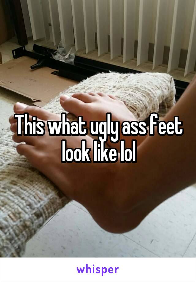 This what ugly ass feet look like lol