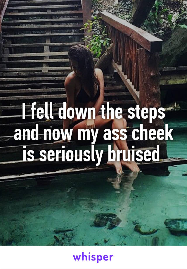 I fell down the steps and now my ass cheek is seriously bruised 