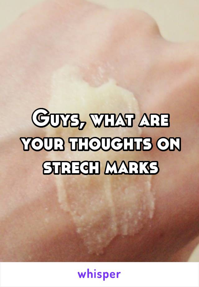 Guys, what are your thoughts on strech marks