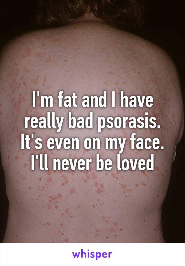 I'm fat and I have really bad psorasis. It's even on my face. I'll never be loved