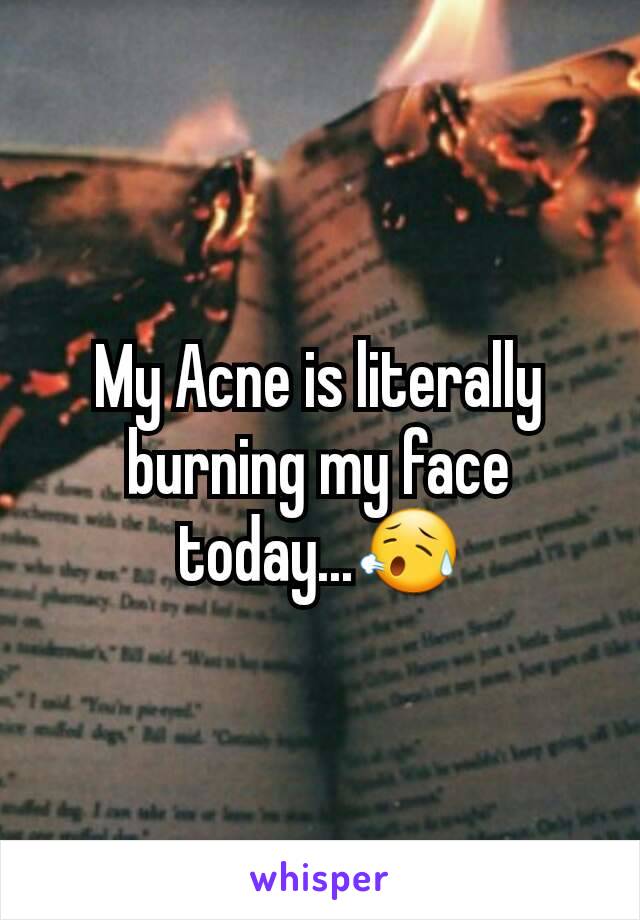 My Acne is literally burning my face today...😥