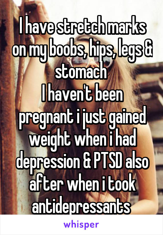 I have stretch marks on my boobs, hips, legs & stomach 
I haven't been pregnant i just gained weight when i had depression & PTSD also after when i took antidepressants 