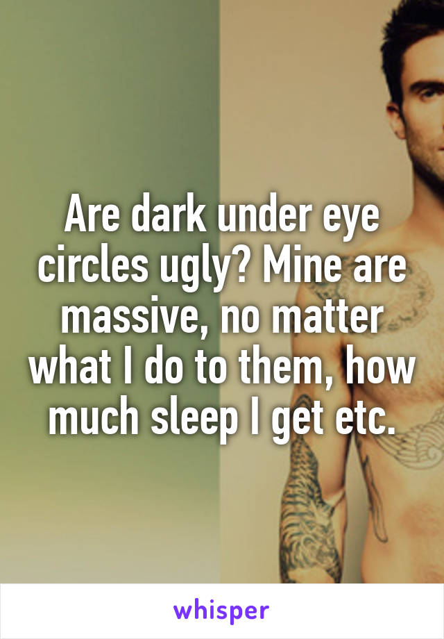 Are dark under eye circles ugly? Mine are massive, no matter what I do to them, how much sleep I get etc.