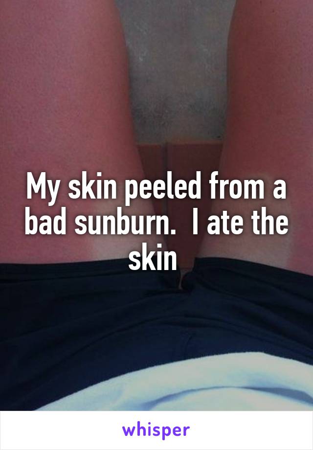 My skin peeled from a bad sunburn.  I ate the skin 