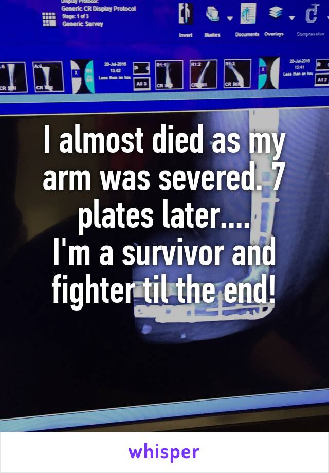 I almost died as my arm was severed. 7 plates later....
I'm a survivor and fighter til the end!
