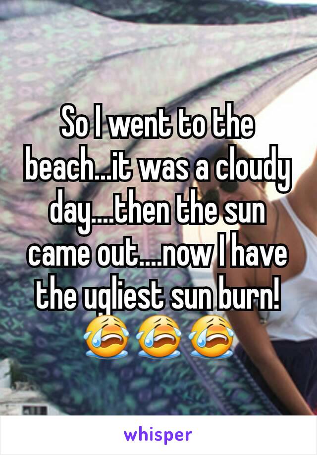 So I went to the beach...it was a cloudy day....then the sun came out....now I have the ugliest sun burn! 😭😭😭